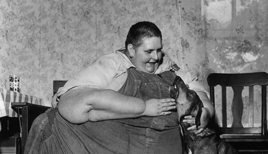 “Overweight by 590 kg”: lay on the couch all day and ate 10 kg of food a day to become the fattest in the world. What did he look like? “Overweight by 590 kg”: lay on the couch all day and ate 10 kg of food a day to become the fattest in the world. What did he look like?