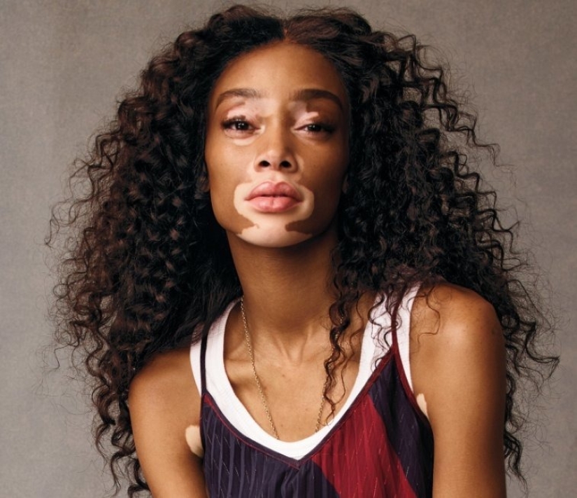 People with an unusual appearance. 8 photos People with an unusual appearance. 8 photos