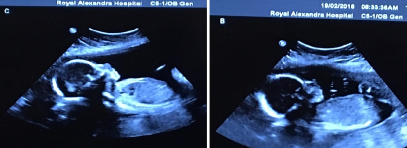 Photo shoot of very rare and absolutely identical quadruplets