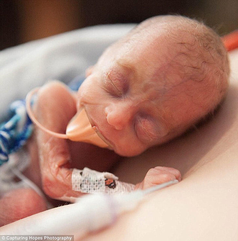 Photographing hope Photographing hope