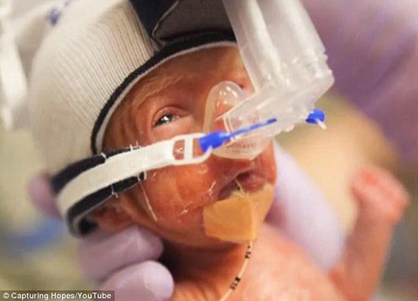 Photographing hope Photographing hope