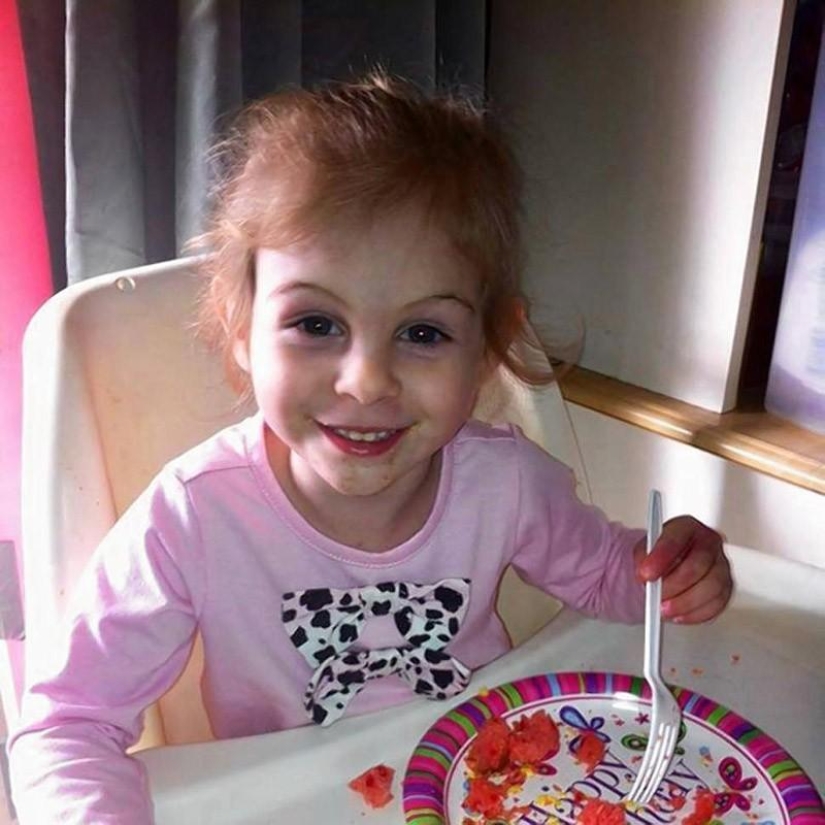 Pit bull mutilated 3-year-old girl kicked out of diner because of her appearance