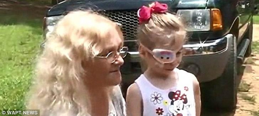 Pit bull mutilated 3-year-old girl kicked out of diner because of her appearance