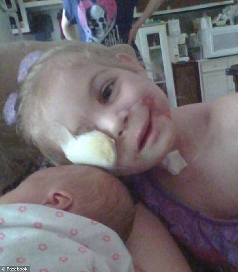 Pit bull mutilated 3-year-old girl kicked out of diner because of her appearance