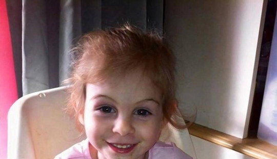 Pitbull mutiló a niña de 3 años y la echaron de restaurante por su apariencia