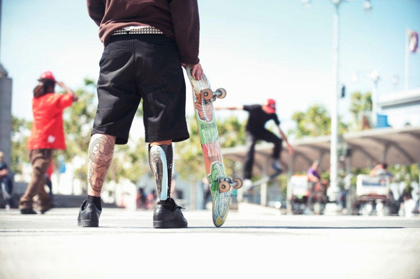Prostheses can also be elegant and stylish!