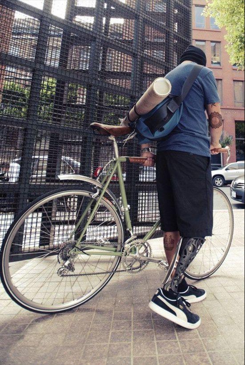 Prostheses can also be elegant and stylish!