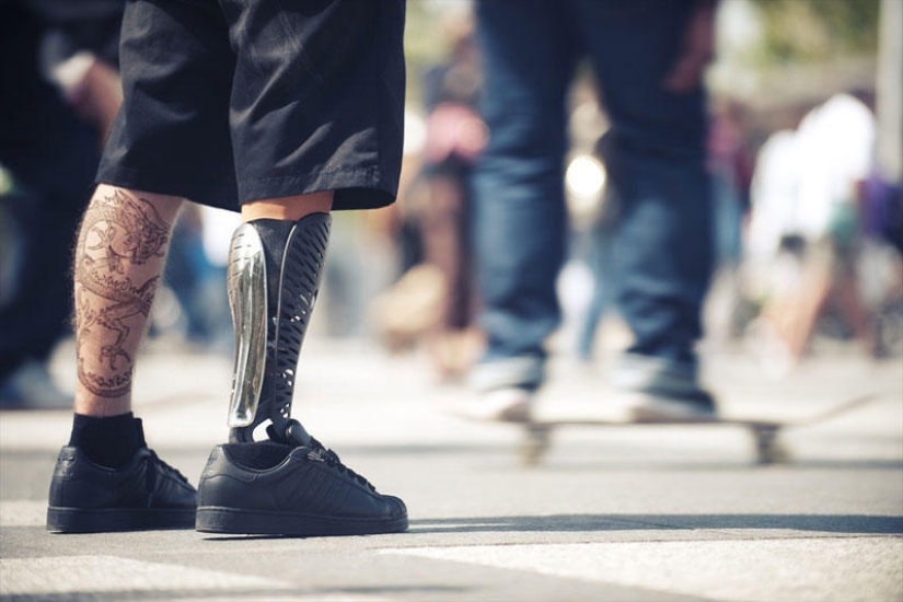 Prostheses can also be elegant and stylish!