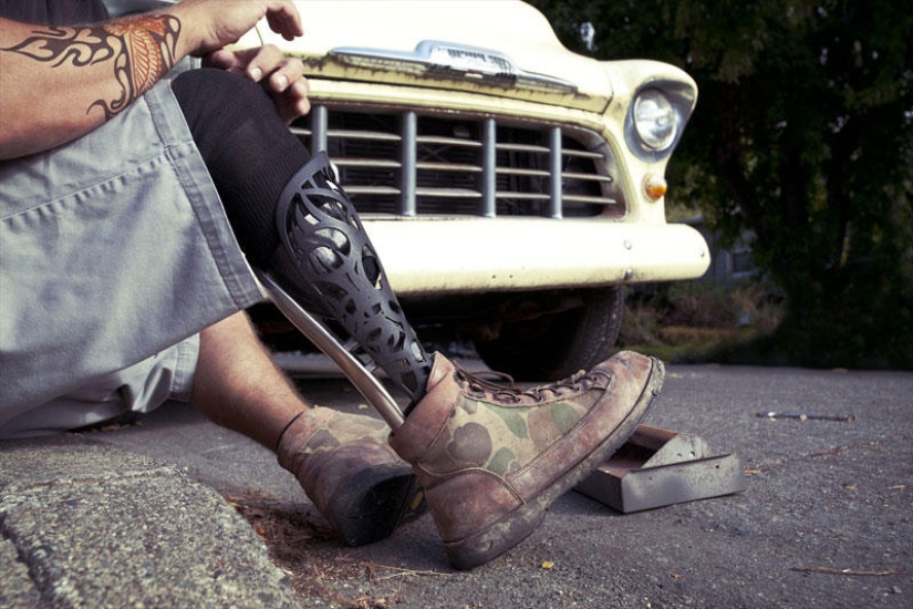 Prostheses can also be elegant and stylish!