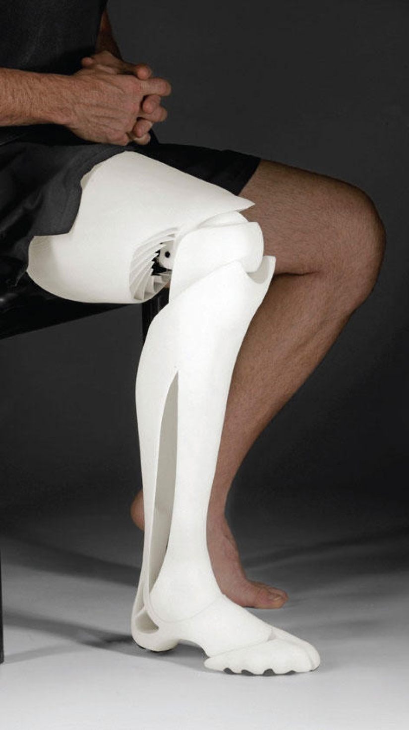 Prostheses can also be elegant and stylish!