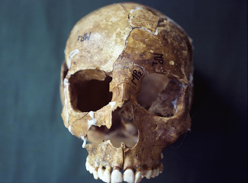 "¿Quién puso a Bella en el olmo?": un hallazgo espeluznante en el bosque sorprendió a un pequeño pueblo "¿Quién puso a Bella en el olmo?": un hallazgo espeluznante en el bosque sorprendió a un pequeño pueblo