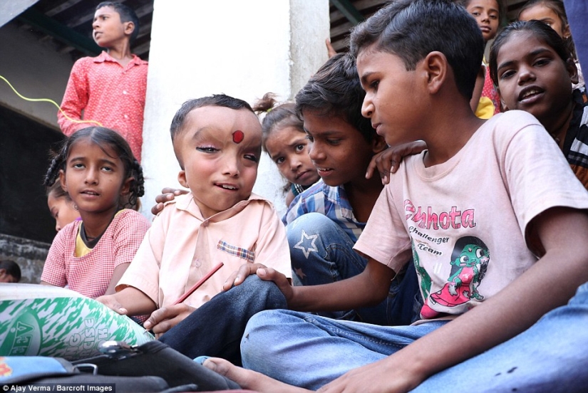 Residents of an Indian village worship a boy with a deformed head as the god Ganesha