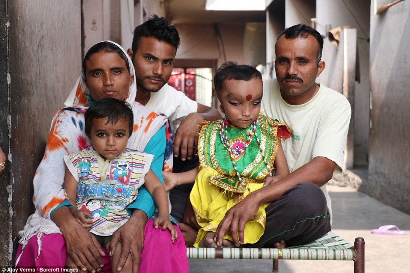 Residents of an Indian village worship a boy with a deformed head as the god Ganesha
