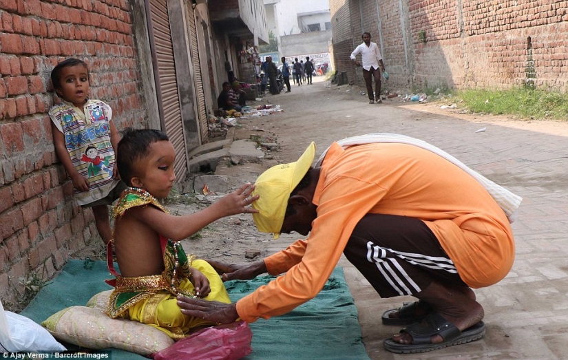 Residents of an Indian village worship a boy with a deformed head as the god Ganesha