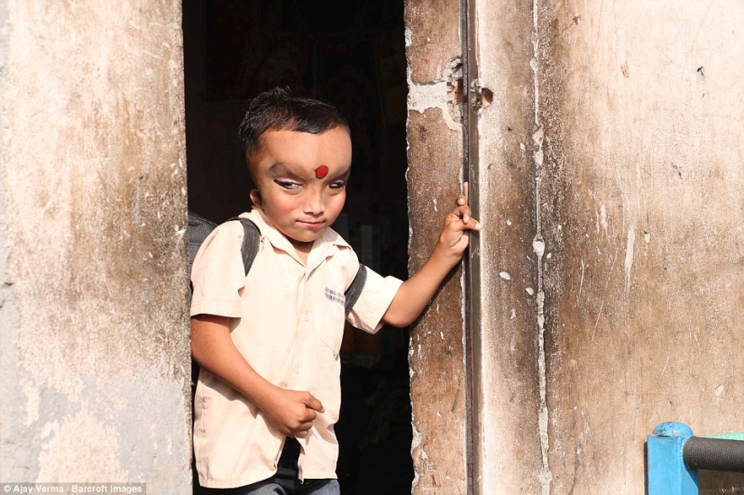 Residents of an Indian village worship a boy with a deformed head as the god Ganesha
