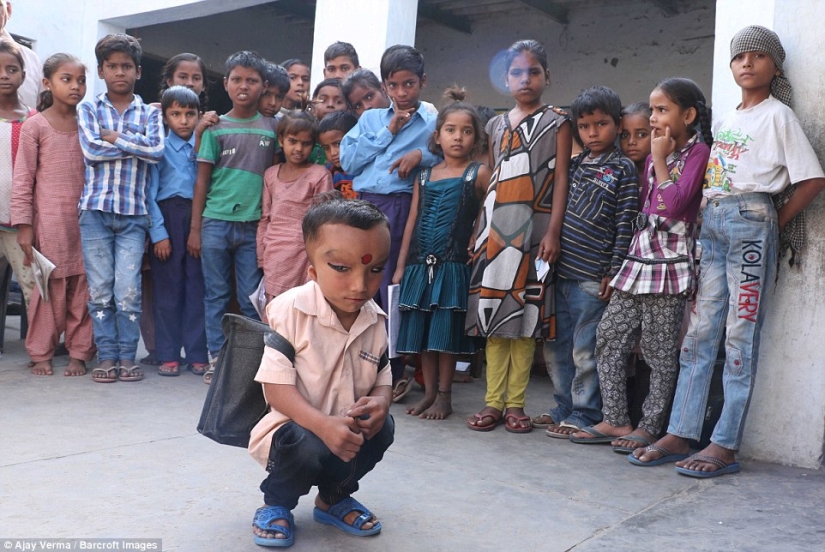 Residents of an Indian village worship a boy with a deformed head as the god Ganesha