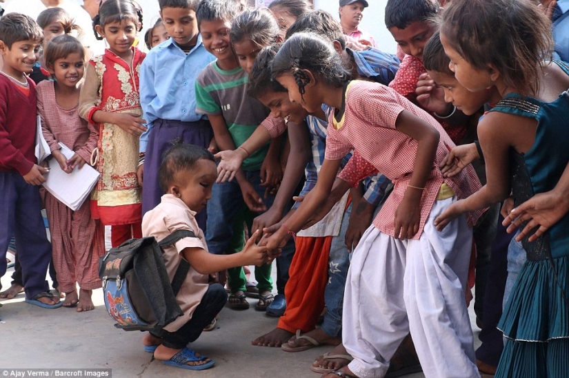 Residents of an Indian village worship a boy with a deformed head as the god Ganesha