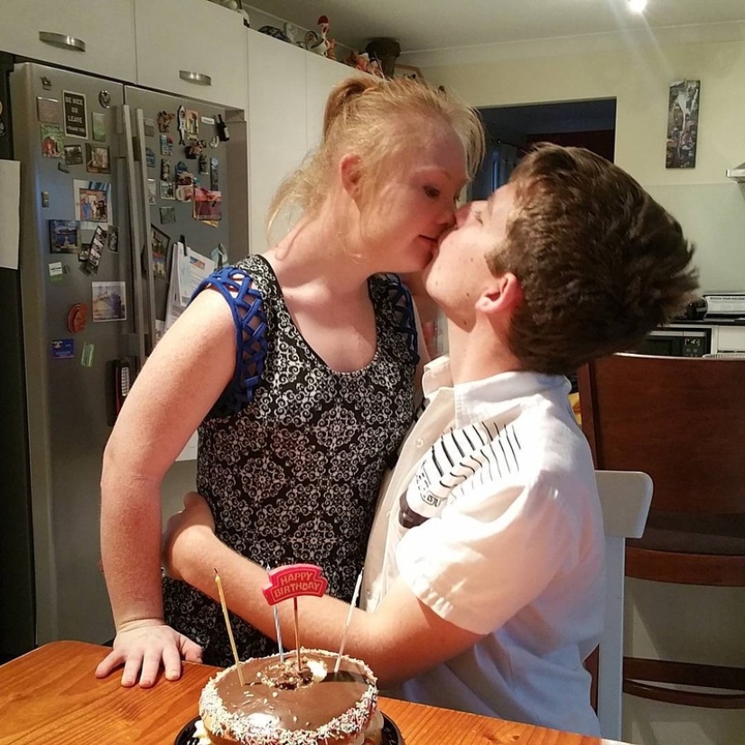 Romantic photos of Down syndrome model Madeleine Stewart and her boyfriend Romantic photos of Down syndrome model Madeleine Stewart and her boyfriend