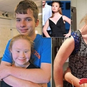 Romantic photos of Down syndrome model Madeleine Stewart and her boyfriend