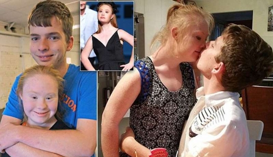 Romantic photos of Down syndrome model Madeleine Stewart and her boyfriend Romantic photos of Down syndrome model Madeleine Stewart and her boyfriend