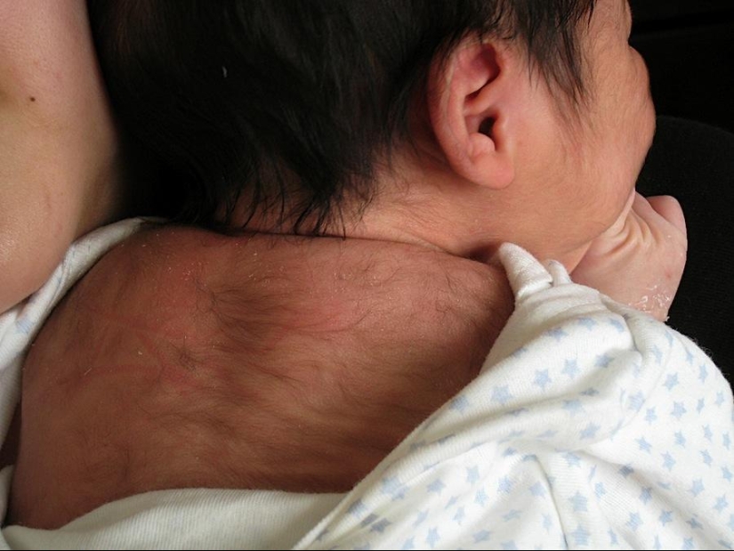 Shocking human mutations