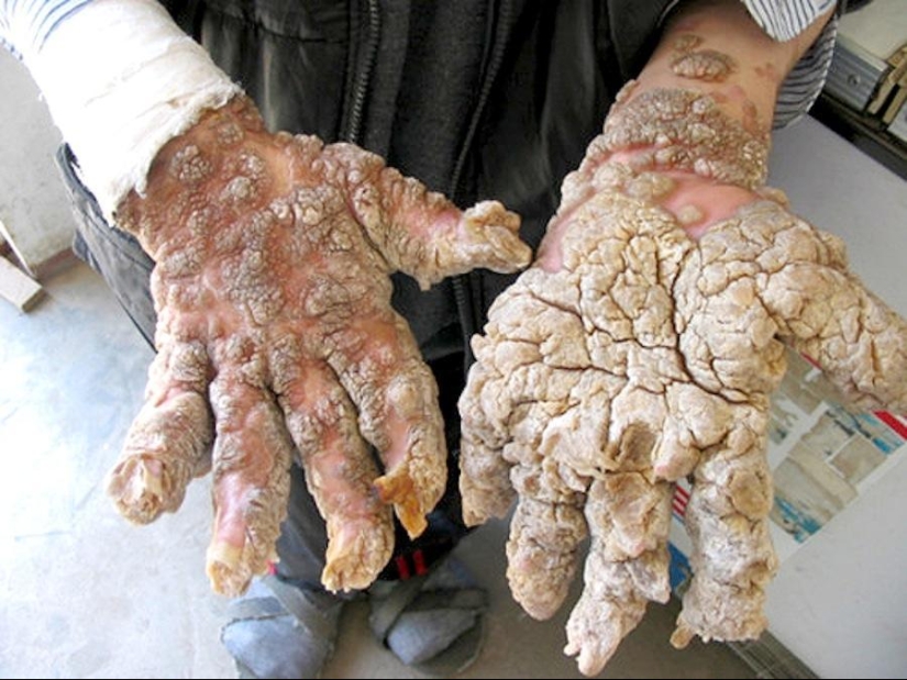 Shocking human mutations