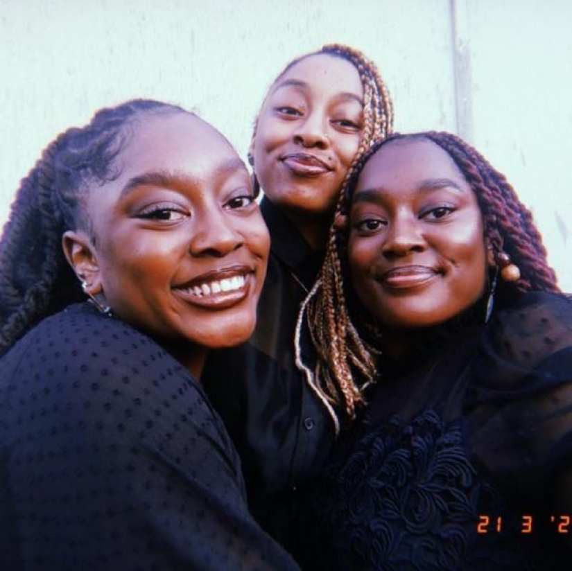 Siamese twins separated in infancy continue to sleep the same way as before the operation