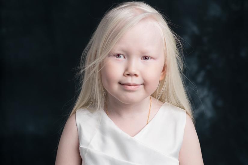 Snow White from Siberia: 8-year-old model with the rarest appearance shocked the Internet