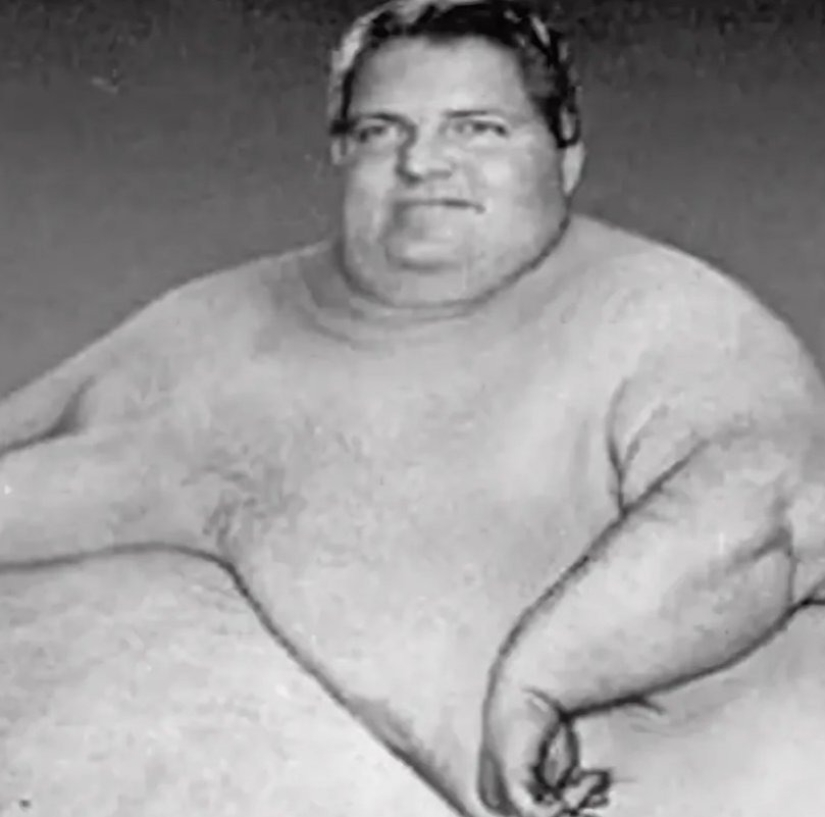 “Sobrepeso por 590 kg”: se tumbó en el sofá todo el día y comió 10 kg de comida al día para convertirse en el más gordo del mundo. ¿Como se veia?