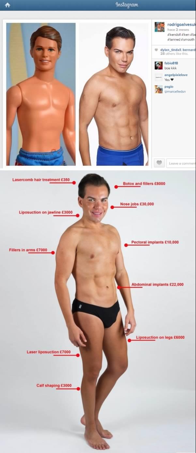 The 7 Most Reckless People With Plastic Surgery Mania The 7 Most Reckless People With Plastic Surgery Mania