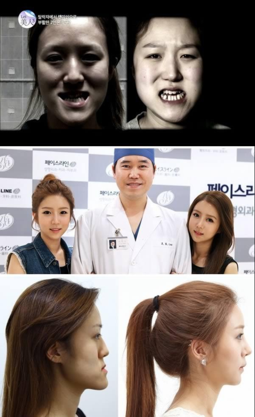 The 7 Most Reckless People With Plastic Surgery Mania The 7 Most Reckless People With Plastic Surgery Mania