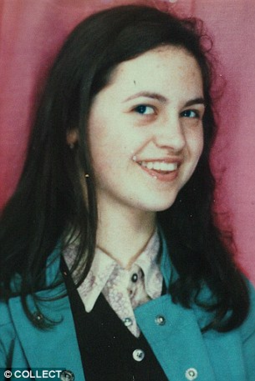 The first woman with a transplanted face died of cancer caused by anti-rejection drugs The first woman with a transplanted face died of cancer caused by anti-rejection drugs