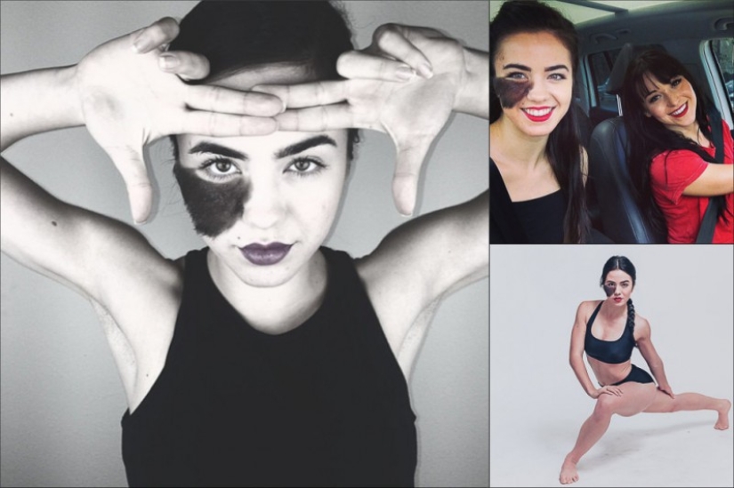 The girl refuses to remove the birthmark, considering it her highlight