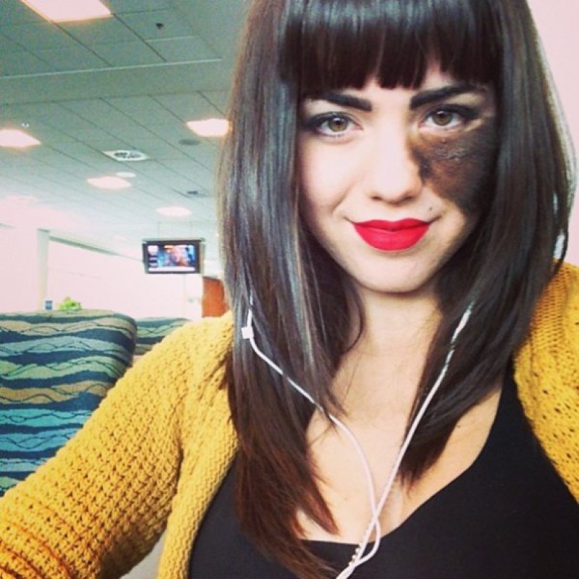 The girl refuses to remove the birthmark, considering it her highlight