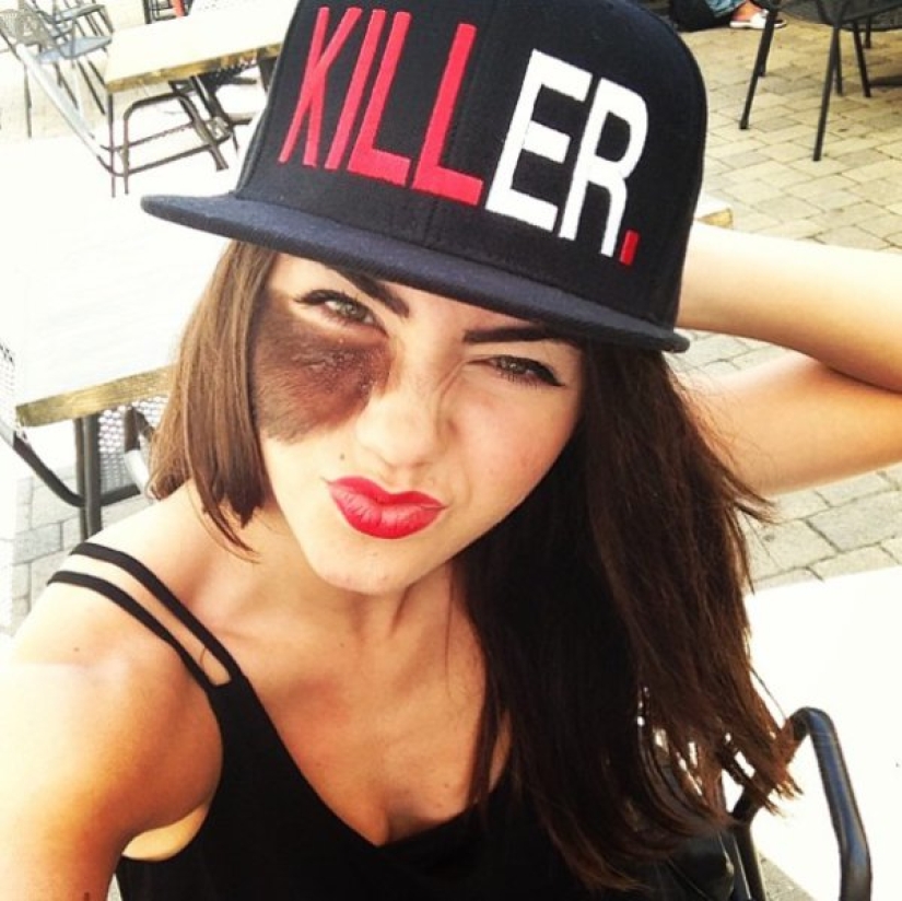 The girl refuses to remove the birthmark, considering it her highlight