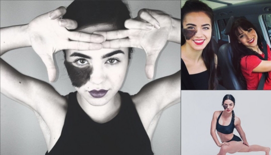 The girl refuses to remove the birthmark, considering it her highlight
