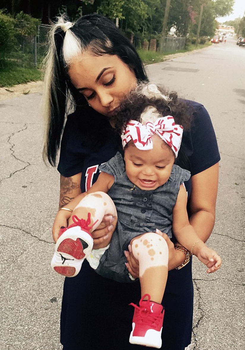 The girl was born with white bangs, exactly the same as her mother, grandmother and great-grandmother
