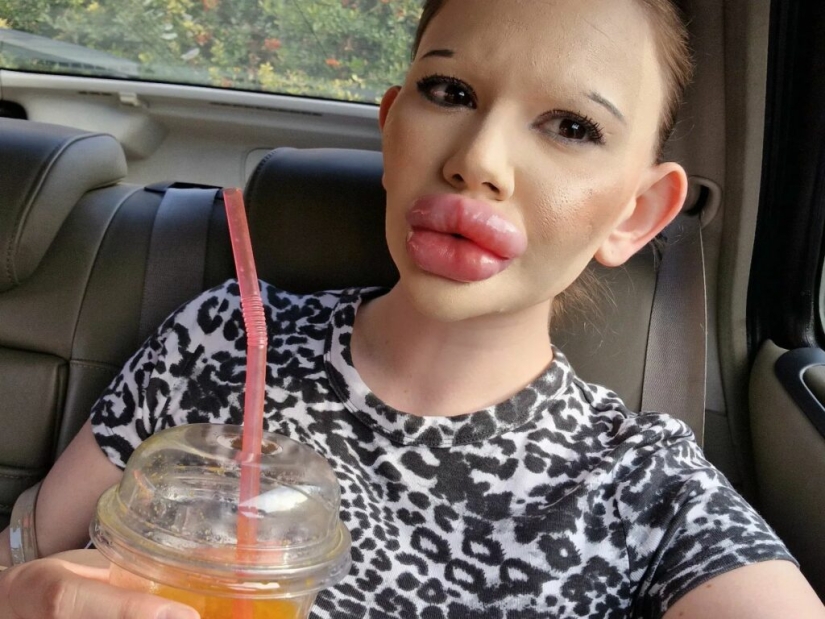 The girl with the biggest lips in the world decided to enlarge her cheekbones The girl with the biggest lips in the world decided to enlarge her cheekbones
