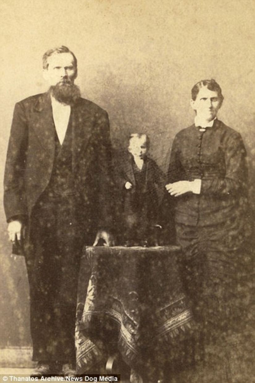 The harsh XIX century: a collection of archival photographs of people with deformities