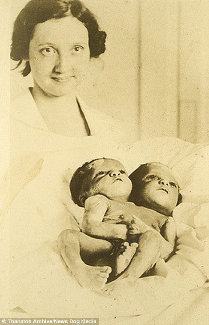 The harsh XIX century: a collection of archival photographs of people with deformities