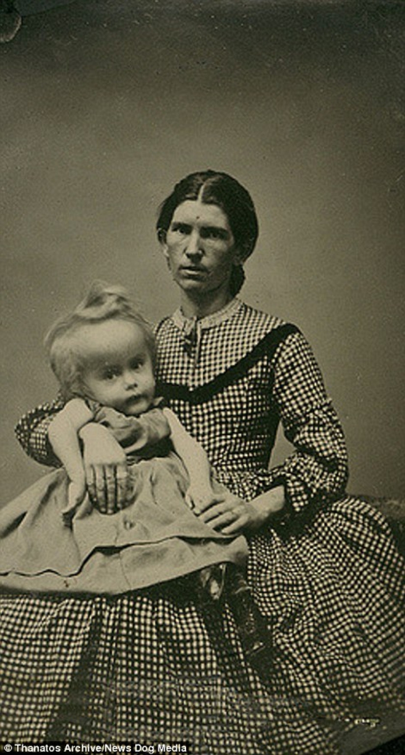 The harsh XIX century: a collection of archival photographs of people with deformities