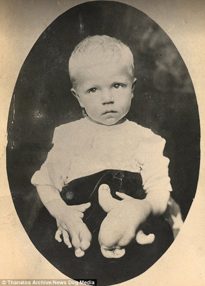 The harsh XIX century: a collection of archival photographs of people with deformities