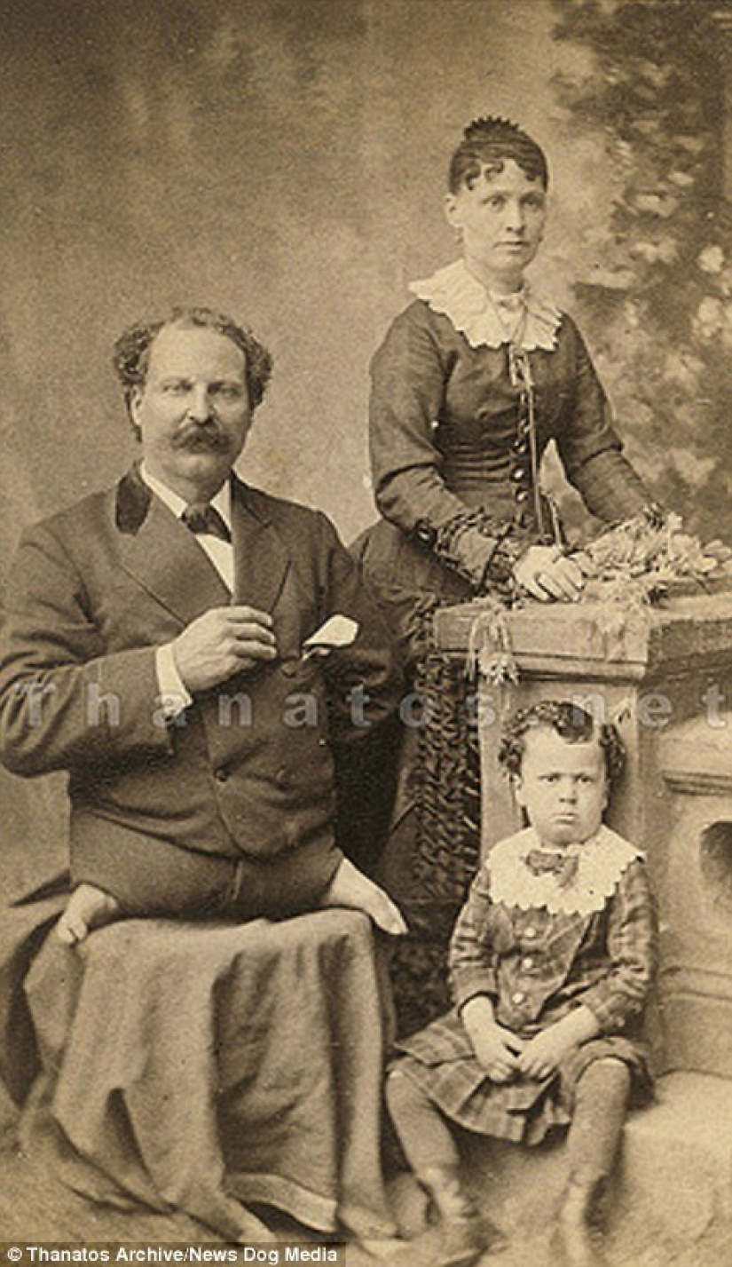 The harsh XIX century: a collection of archival photographs of people with deformities