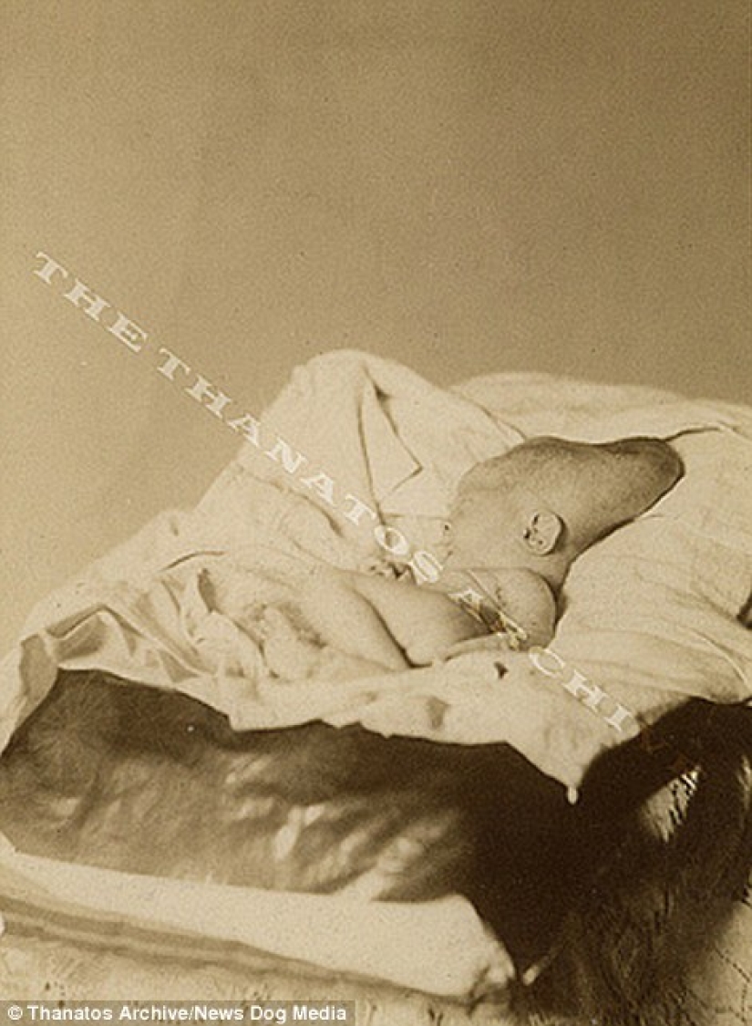 The harsh XIX century: a collection of archival photographs of people with deformities