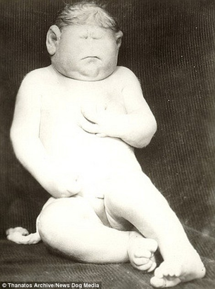 The harsh XIX century: a collection of archival photographs of people with deformities