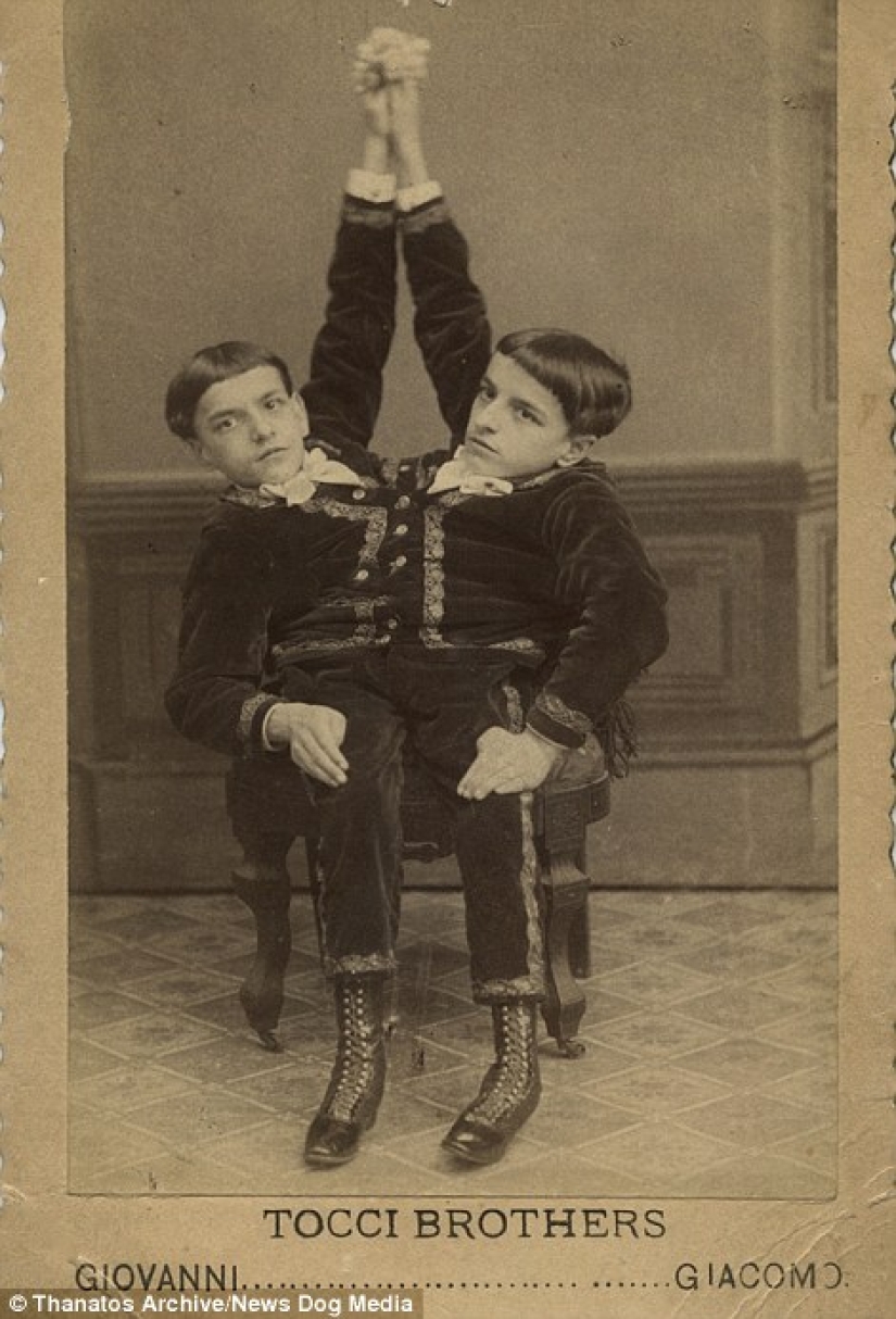 The harsh XIX century: a collection of archival photographs of people with deformities