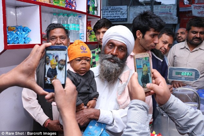 The inexplicable story of a 21-year-old Indian who got stuck in the body of a baby