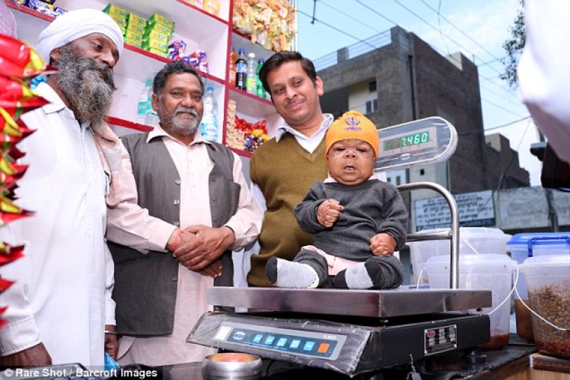 The inexplicable story of a 21-year-old Indian who got stuck in the body of a baby