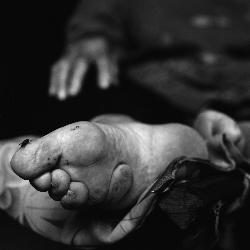 The last living Chinese women with lotus feet
