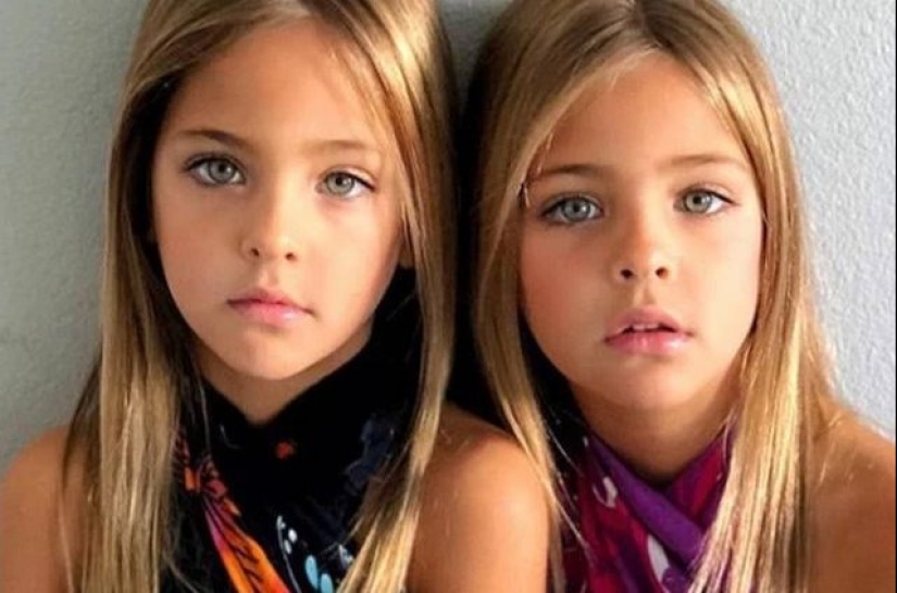 The most beautiful twins in the world: their life many years after gaining fame and fame The most beautiful twins in the world: their life many years after gaining fame and fame